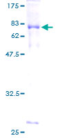 12.5% SDS-PAGE Stained with Coomassie Blue.